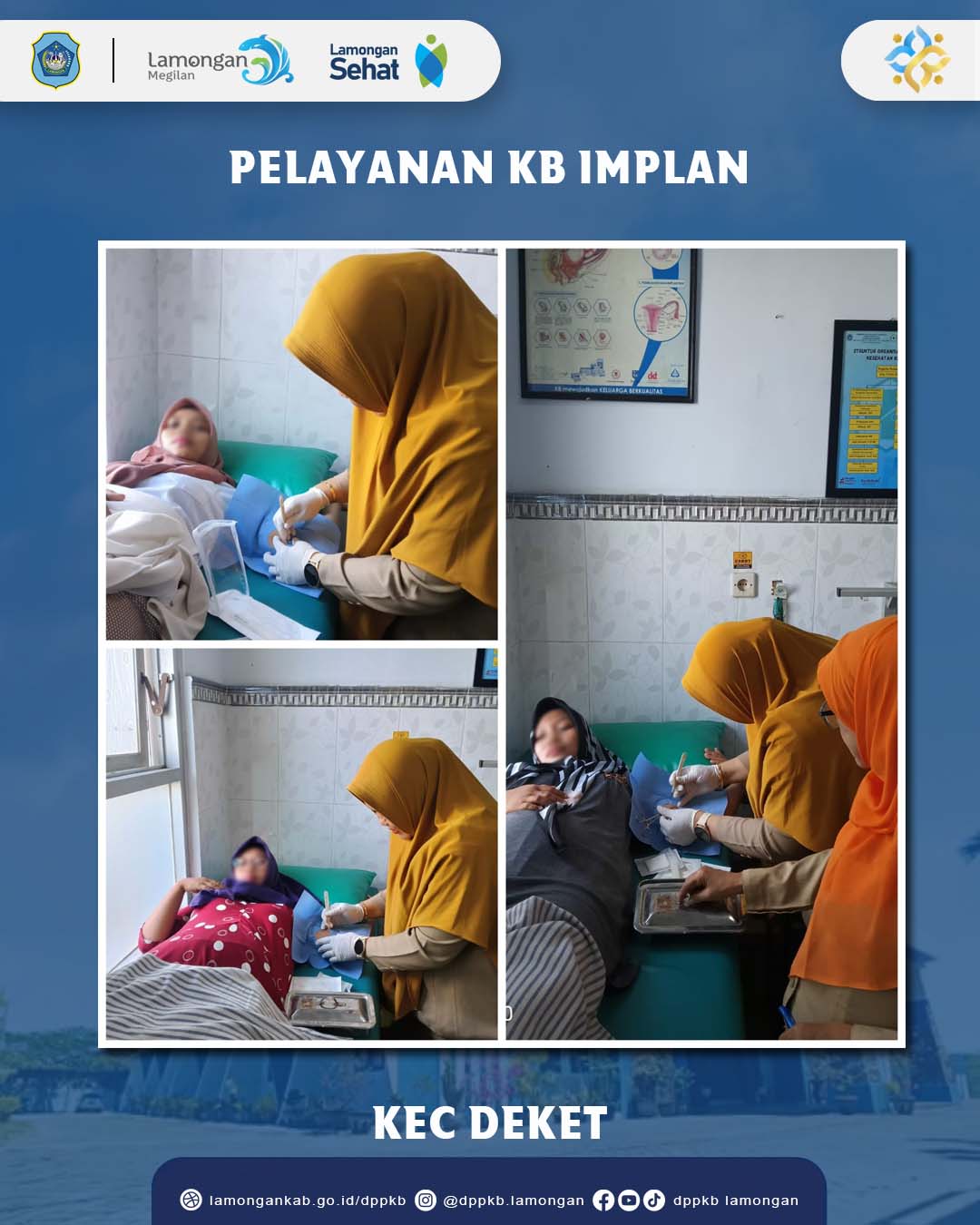 PELAYANAN IMPLAN KB