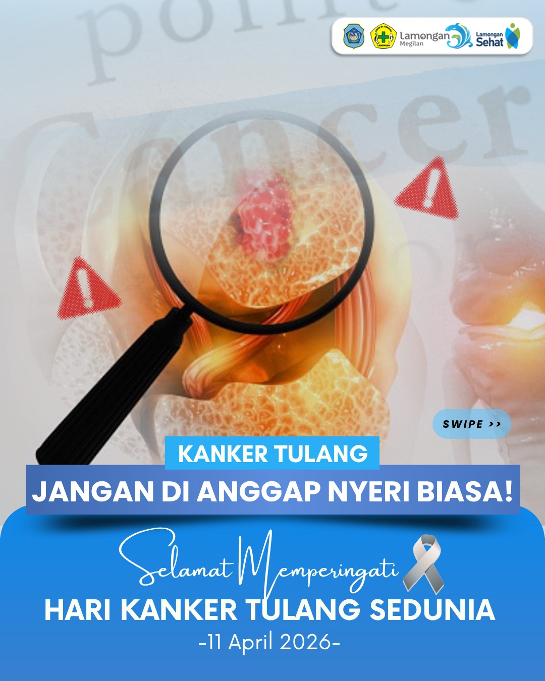 Foto: Hari Kanker Tulang Sedunia